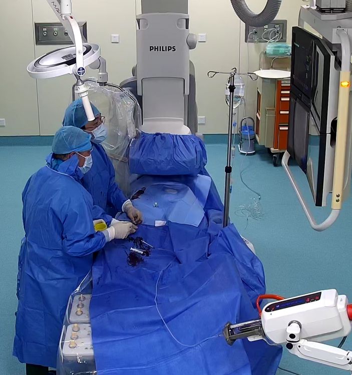 不用切除，讓巨大前列腺增生變小！  ——我院成功開展介入治療前列腺增生